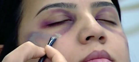How To Cover Bruises With Makeup