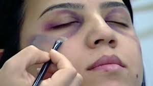 How to cover up bruises