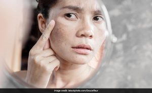 The causes of skin redness when exposed to the sun