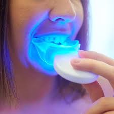 What is the safest whitening for sensitive teeth?